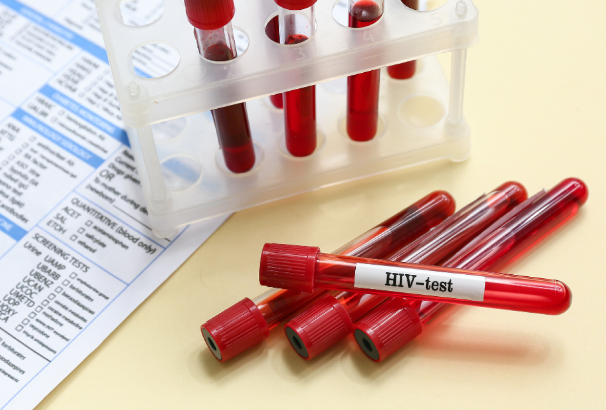 HIV testimisnädal